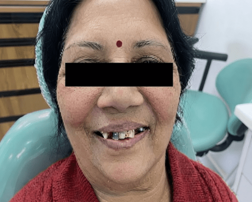 59